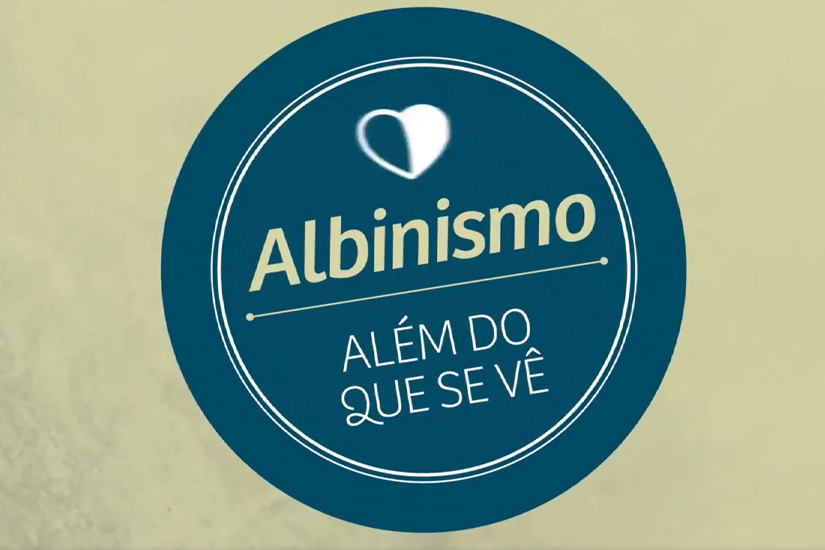 Read more about the article Dia internacional da conscientização sobre o Albinismo